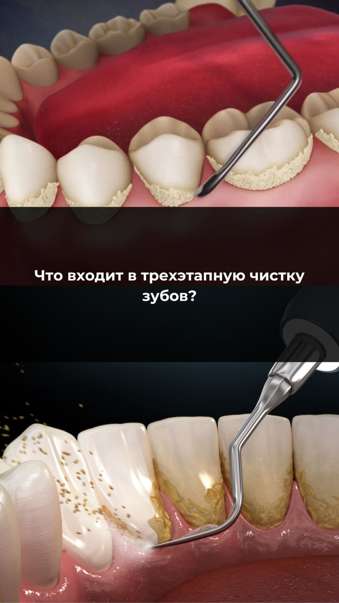 Протезирование