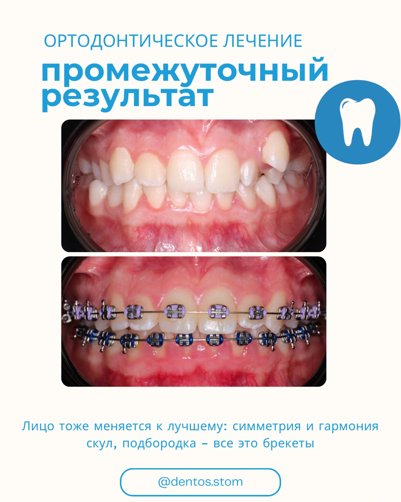 Консультация DENTOS